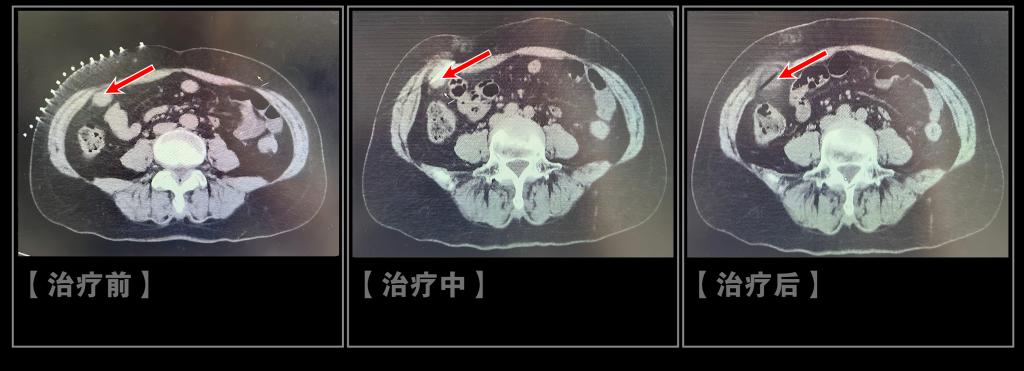 D9C7
