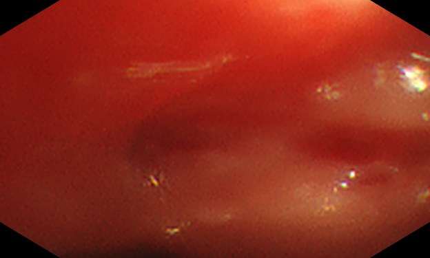 A684
